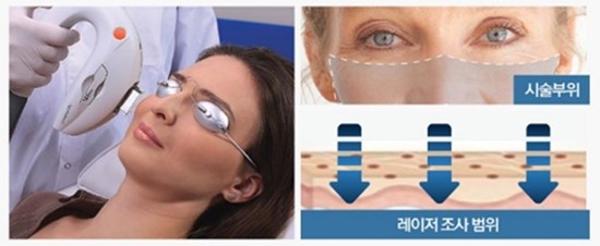 사진 제공 = 잠실삼성안과