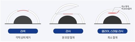 사진 제공= 잠실삼성안과
